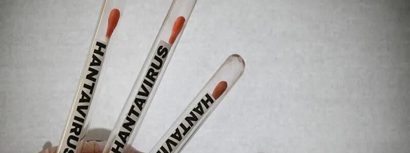 Hantavirus : l’OMS se veut rassurante
